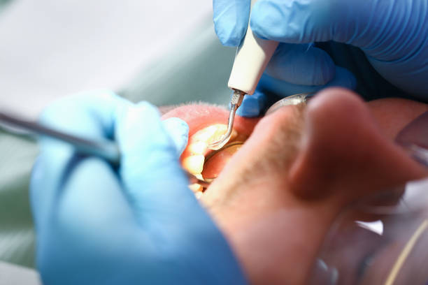 Best Pediatric Emergency Dentist in Pekin, IL